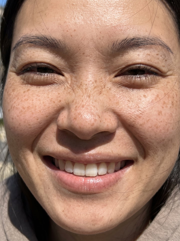Close-Up of Smiling Woman with Freckles